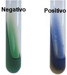 4. Citrato Citrato citratase ciclo de Krebs ciclo da fermentação do citrato Indicador de ph: azul de bromotimol ph 8,4=coloração