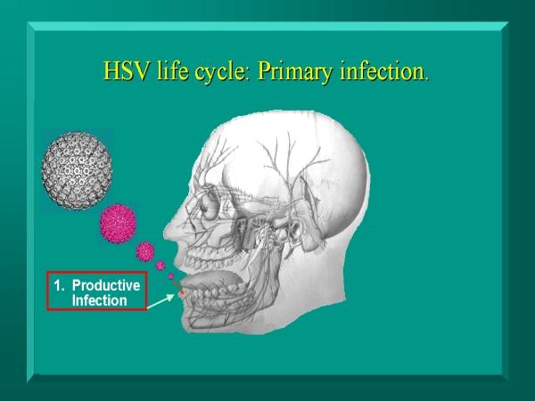 Transmissão HSV-1 secreções respiratórias HSV-2 contato sexual vertical 85% primoinfecção ð