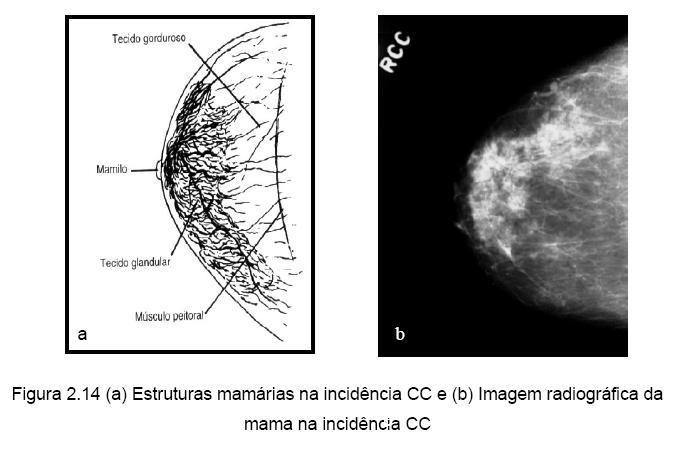 1- Mamografia Convencional Uma característica particular do equipamento mamográfico é a modificação do tubo de raios X, enquanto geralmente é usado alvo de tungstênio nos sistemas convencionais, o