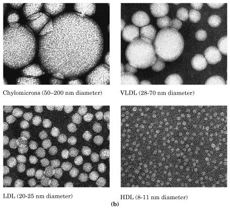 Frações de lipoproteínas 50-200 nm