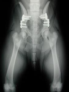 30 Figura 9: Radiografia da fixação da placa angulada com parafusos.