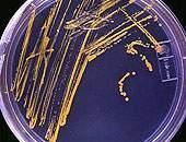 Tratamentos alternativos Uma bactéria naturalmente resistente a metais pesados está sendo utilizada em pesquisa da USP, para criar