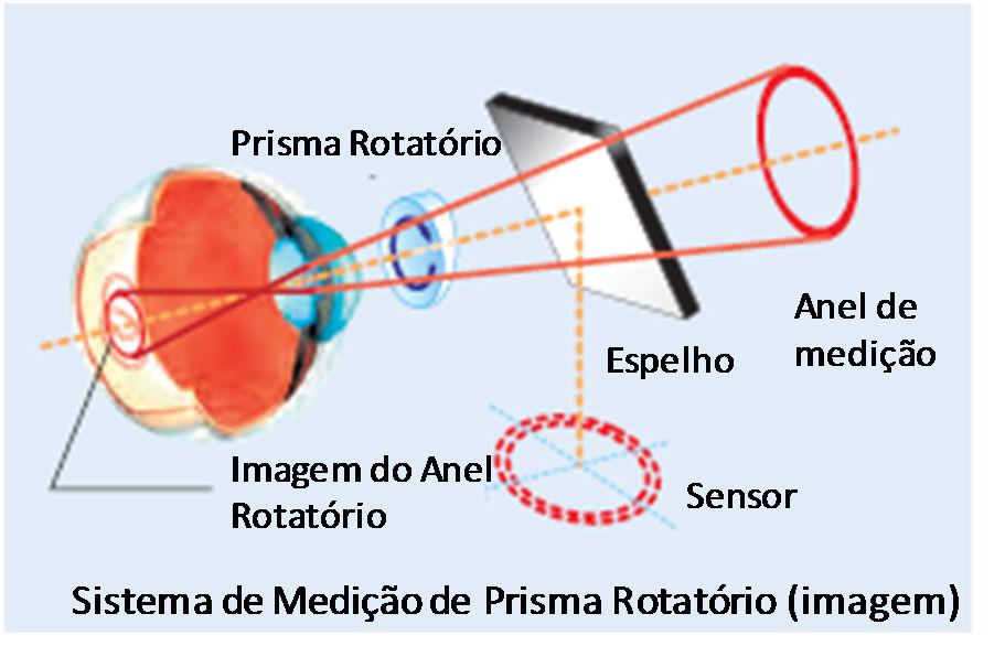 Movimentos Uniformes A capacidade da Topcon de reduzir o peso em aproximadamente 23 kg contribuiu para uma operação mais suave da unidade ao usar a alavanca de controle X-Y.