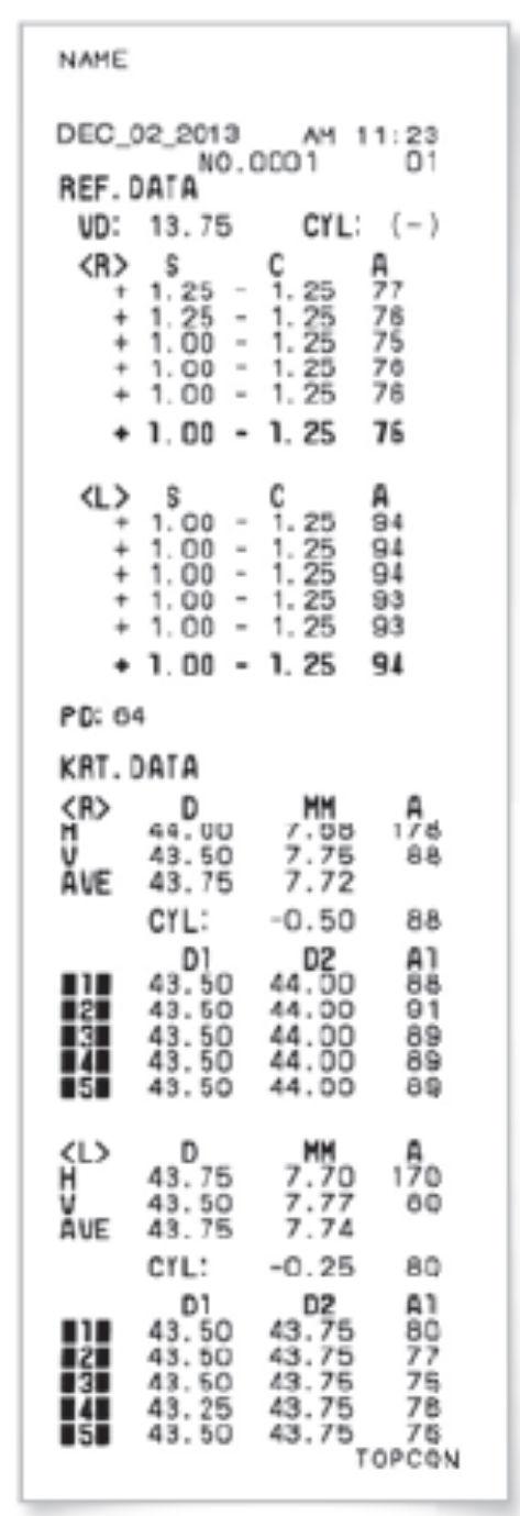 Especificações Medição da Força de Refração Medição da Curvatura da Córnea Variação da Medição da PD Terminal de Transporte de Dados Dimensões Peso Alimentação KR-800 RM-800 Força de refração