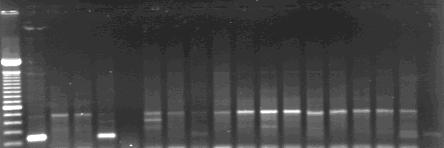 93 M 1 2 3 4 5 6 7 8 9 10 11 12 13 14 15 16 17 18 200 pb Figura 14. Fotografia de eletroforese em gel de agarose 1,3% corado com Brometo de Etídeo.
