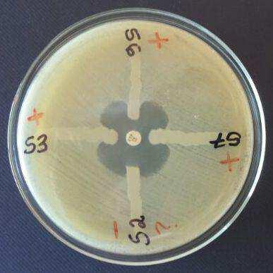 P á g i n a 18 Figura 6. Teste modificado de Hodge utilizando o antibiótico ertapenem (10 µg/ml). Testes positivos (S3, S6 e S7), teste negativo (S2). 5.
