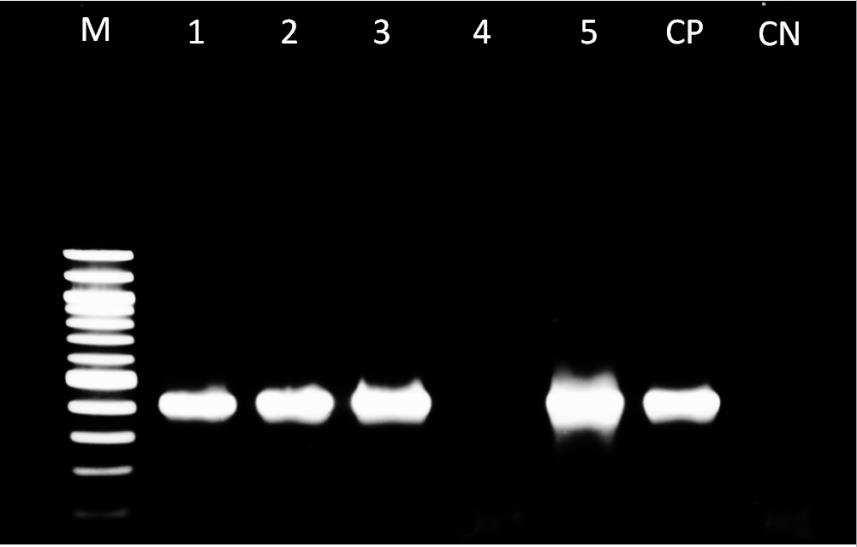P á g i n a 20 Tabela 5. Resultado do perfil de susceptibilidade das amostras de S. marcescens produtoras de carbapenemase frente aos antibióticos ertapenem, meropenem e imipenem.