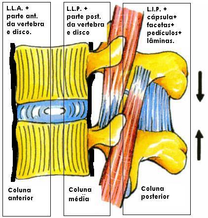 facetária Aumento da distância interpedicular