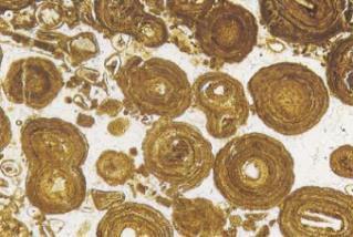 21 Oncólitos: Partículas formadas por lâminas micríticas concêntrica