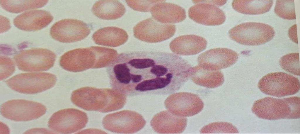 O neutrófilo segmentado se apresenta como uma célula de núcleo multilobulado (podendo apresentar de 2 a 4 lóbulos) de cromatina purpúrea escura e densa, cujos lóbulos são ligados por um tênue