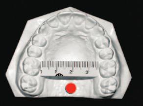 mostrando alterações anteroposterior e vertical, e ) vista oclusal superior mostrando a deficiência