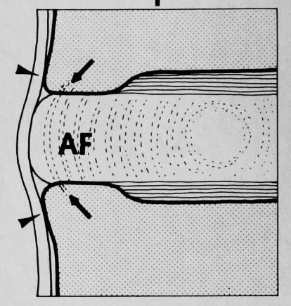 disco intervertebral e do ligamento longitudinal anterior: tração