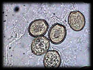 Esporos móveis = dispersão em locais aquáticos Unicelulares e multicelulares (micélios) Vida livre e parasitas