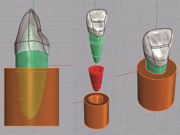 65 Fig. 1: Modelo CAD do dente hígido Fig.
