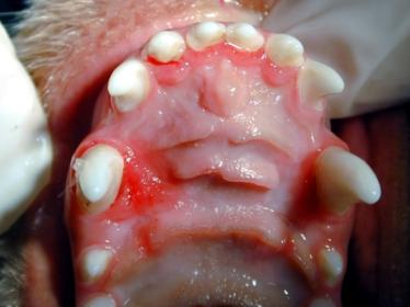 a anquilose e/ou reabsorção óssea e radicular OBS: um dente com