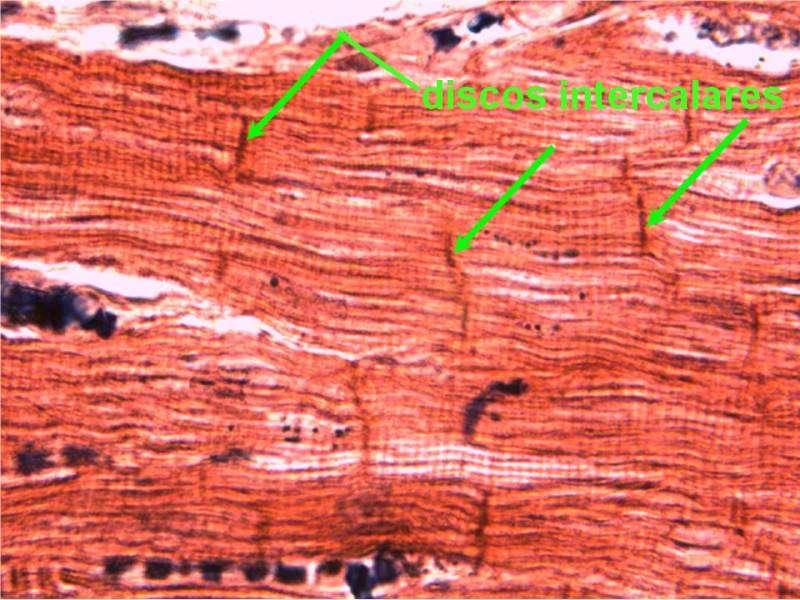 BIOLOGIA, 1º Ano Classificação e características do tecido muscular TECIDO MUSCULAR ESTRIADO