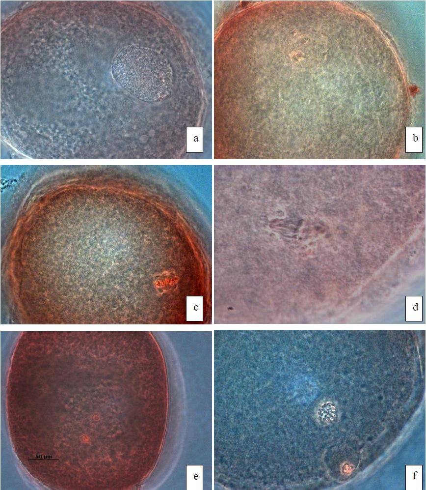 40 comparativamente à metáfase I. Placa metafásica aparente. VG (vesícula germinativa); VGBD (quebra da vesícula germinativa).