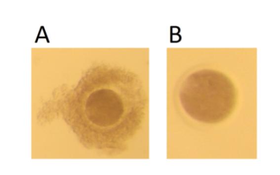 48 Figura 7: Ovócitos antes e após o desnudamento (retirada total das células do cumulus).