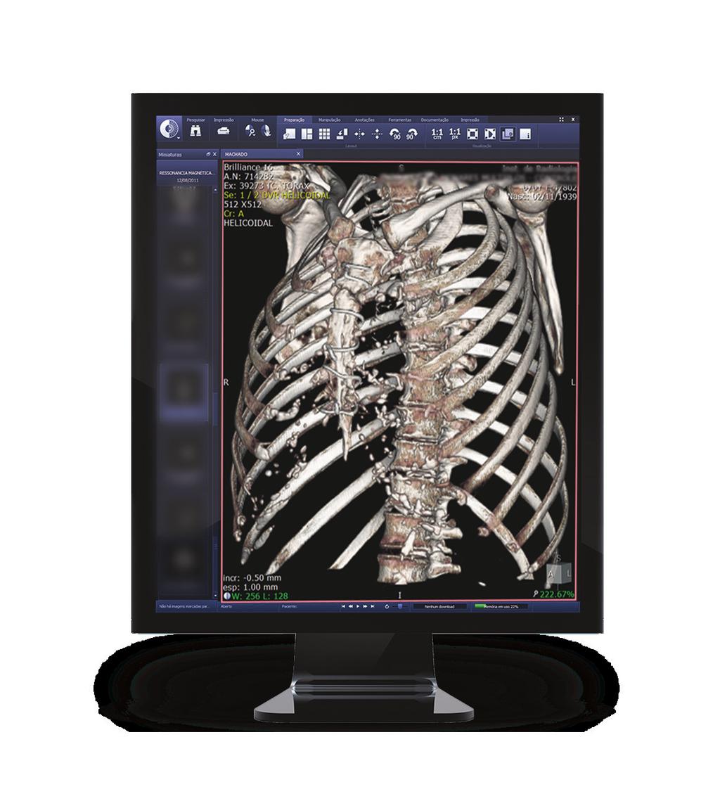 #2 Acesso à Central Radiológica Fácil acesso às imagems digitais A Central Radiológica coordena, digitalmente, as imagens dentro do sistema, através do PACS.