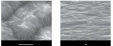 41 (a) (b) 5 µm 1 µm Figura 14 - Microscopia eletrônica de varredura da superfície do filme cristalizado a 140 C a partir da solução de DMF antes (a) e após (b) estiramento a 80 C com R = 4 (adaptado
