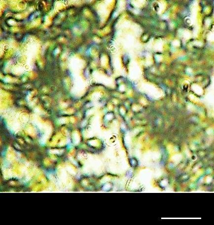 Microscopia ótica dos filmes de PVDF cristalizados a (a) 50, (b) 60 e (c) 90 C a partir