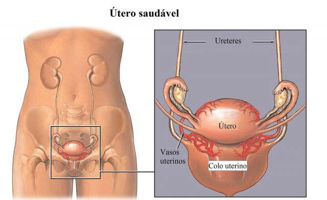 Lesão urológica Acomete ureteres e bexiga Fatores de risco: Cirurgias prévias Aderências Malignidade Uso do