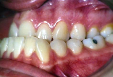 periodontal.