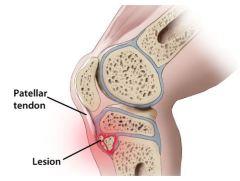 http://differentialdiagnosislowerleg.weebly.