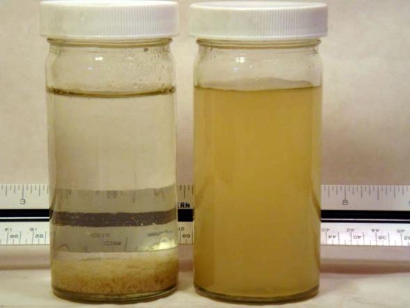 sedimentação, e reações químicas de precipitação Biológicas: uso de microrganismos
