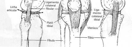 Anatomia Face Lateral Epicôndilo lateral e linha articular - Epicôndilo lateral do fêmur é uma proeminência óssea na face lateral da porção distal do fêmur, com