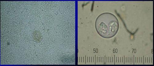 Visualização em microscopia óptica de oocistos esporulados e/ou não esporulados nas fezes Alça intestinal de ave com coccidiose X Alça intestinal de ave normal Tratamento -