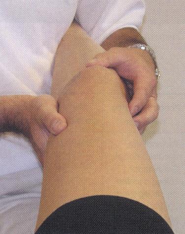 Ligamento Colateral Lateral: LCL