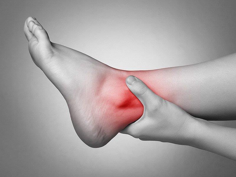 Entorses de Tornozelo Entorses de tornozelo estão entre as lesões ortopédicas mais comuns e podem acometer todas as faixas etárias, embora tenham o seu pico no adulto jovem,