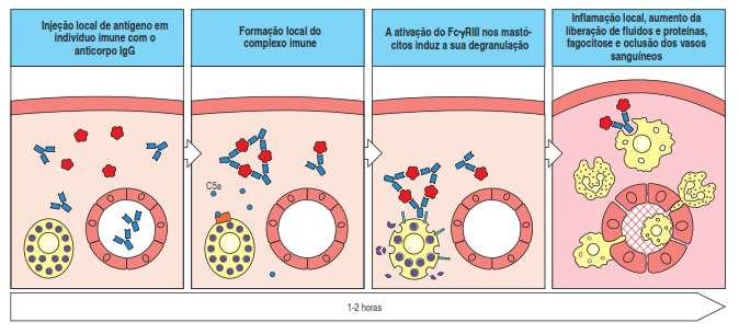 Figura - A deposição de complexos imunes nos tecidos locais causa uma resposta