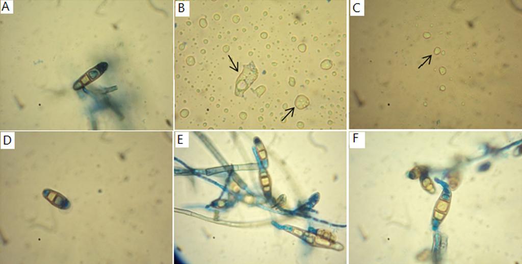 Fitotecnia e Defesa Fitossanitária Figura 2. Atividade das fases do extrato bruto de M. tenuiflora sobre conídios de Curvularia inaequalis.