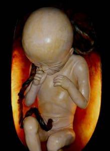 Biologia Humana Zona Azul Modelo de feto com sete meses.
