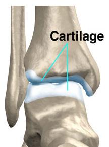 CARTILAGEM É uma forma elástica de tecido conectivo semi-rígido - forma partes do esqueleto nas quais ocorre movimento.