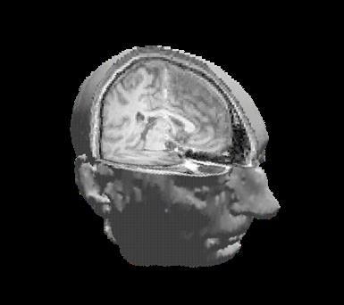 Alinhamento de estruturas em imagens médicas Conceitos (I) O alinhamento consiste na utilização de um