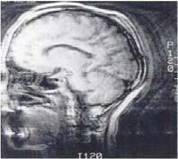 Alinhamento de estruturas em imagens médicas Conceitos (II) Porquê alinhar as imagens?