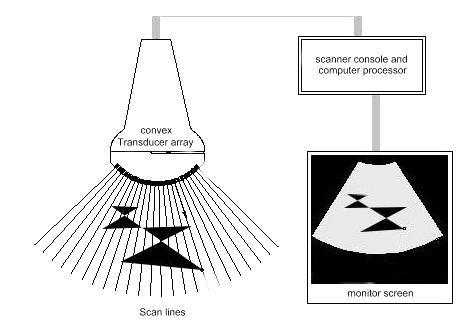 Ondas Sonoras O diagnóstico de ultra sonografia baseia se na reflexão de ondas ultrasónicas