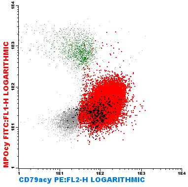 Leucemia aguda de fenótipo misto Leucemia Bilinhagem Populações