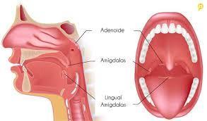 13 1 INTRODUÇÃO As adenoides são pequenas massas difusas de tecido linfoide e nódulos linfáticos, encontram-se na parede faringeana póstero-superior, pouco acima do nível inferior do palato mole, em