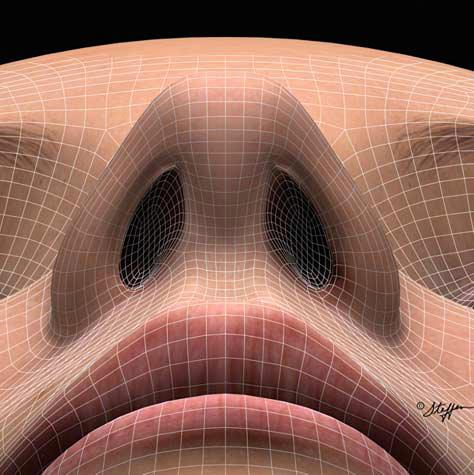33 Em uma visão basal o arco cartilaginoso que dá forma às narinas deve ter formato triangular desprovido de pinçamentos. Os triângulos de tecidos moles devem ser suaves.