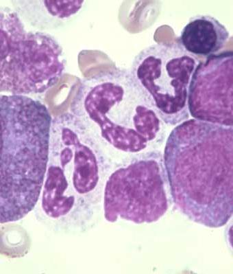 GRANULOPOIESE: hierarquia BASTONETE ou BASTÃO núcleo com aspecto de ferradura cromatina densa granulações secundárias específicas menores SEGMENTADO