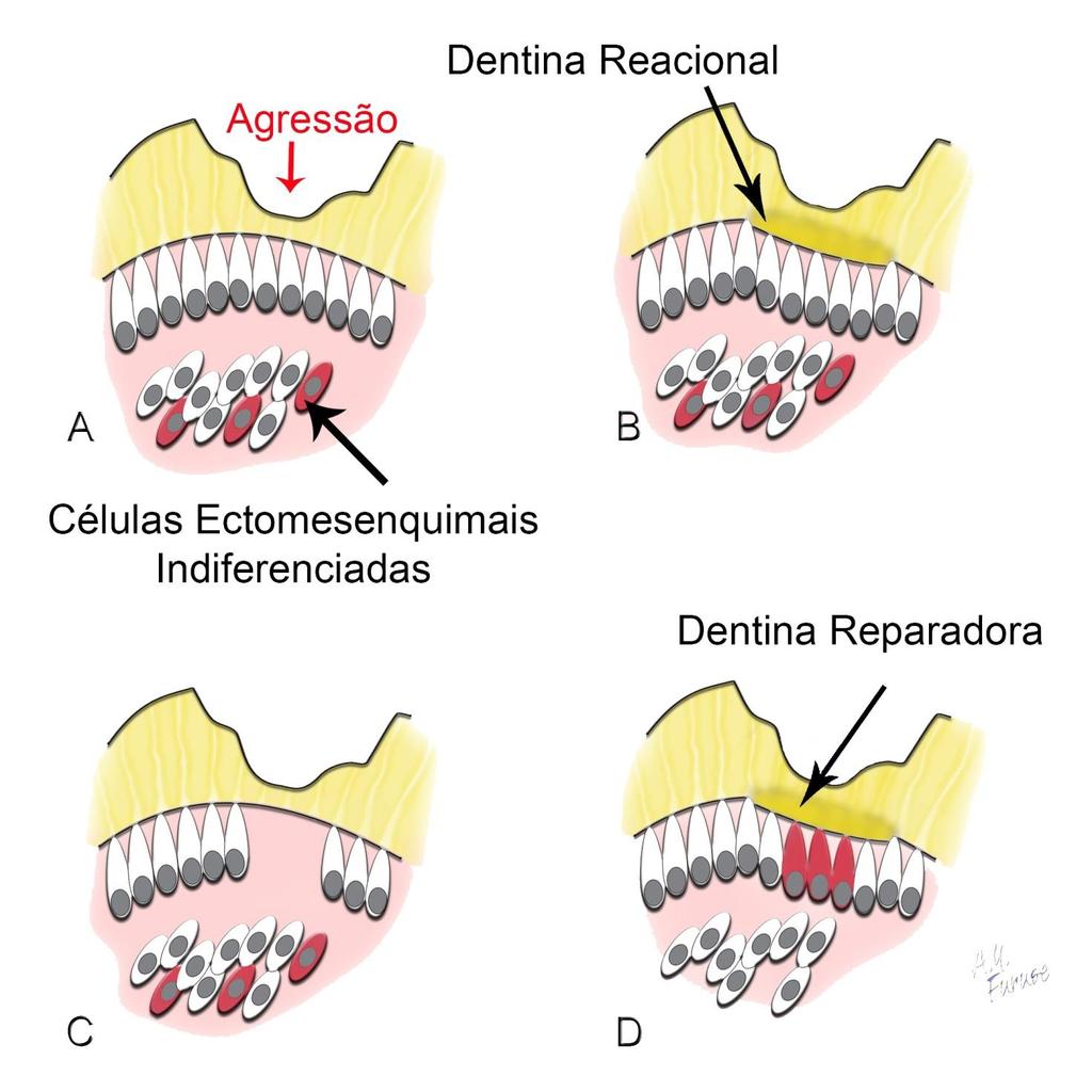 Dentina Reacional