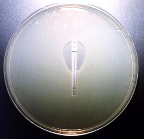 O teste de disco-difusão é um método prático, de fácil execução e idealizado para bactérias de crescimento rápido.