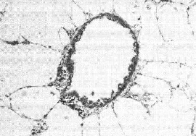 O quêsustenta a PVA? Resistência ao fluxo de ar em humanos Ou seja, a somatória de milhões de tubinhos émuito maior do que a traquéia!