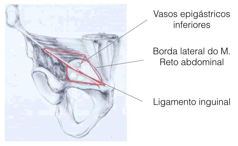 Figura 1 - Triangulo de Hasselbach Sinais e Sintomas As he rnias podem ser detectadas em exame de rotina, em geral por queixa de dor, desconforto e aumento de volume na região inguinal,