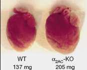 causas Centrais 1. Dispneia, VE/VO2, VCO2, espaço o morto/vol.corrente; WT DKO 2. acidose metabólica.