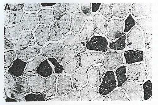 de fibras : miosina ATPase